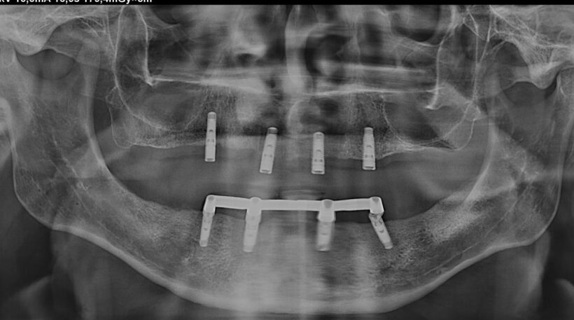 {{brizy_dc_image_alt imageSrc=