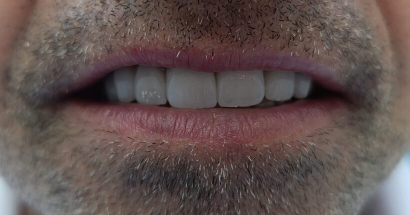 {{brizy_dc_image_alt imageSrc=