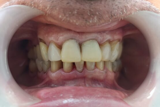 {{brizy_dc_image_alt imageSrc=